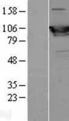 Western Blot: Glycogen phosphorylase, muscle form Overexpression Lysate (Adult Normal) [NBL1-15022] Left-Empty vector transfected control cell lysate (HEK293 cell lysate); Right -Over-expression Lysate for Glycogen phosphorylase, muscle form.