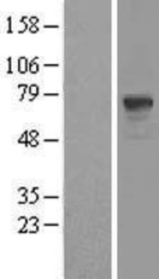 Western Blot: PDE9A Overexpression Lysate (Adult Normal) [NBL1-14233] Left-Empty vector transfected control cell lysate (HEK293 cell lysate); Right -Over-expression Lysate for PDE9A.