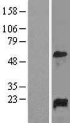 Western Blot: GADD45A Overexpression Lysate (Adult Normal) [NBL1-10934] Left-Empty vector transfected control cell lysate (HEK293 cell lysate); Right -Over-expression Lysate for GADD45A.