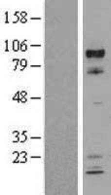 Western Blot: HIF-1 beta Overexpression Lysate (Adult Normal) [NBL1-07720] Left-Empty vector transfected control cell lysate (HEK293 cell lysate); Right -Over-expression Lysate for HIF-1 beta.