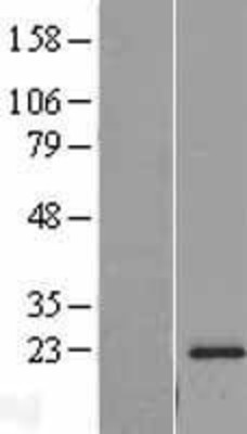 Western Blot: RPL18A Overexpression Lysate (Adult Normal) [NBL1-15512] Left-Empty vector transfected control cell lysate (HEK293 cell lysate); Right -Over-expression Lysate for RPL18A.