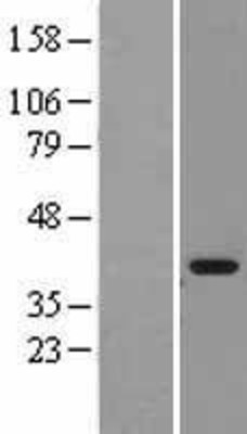 Western Blot: MDH1 Overexpression Lysate (Adult Normal) [NBL1-12964] Left-Empty vector transfected control cell lysate (HEK293 cell lysate); Right -Over-expression Lysate for MDH1.