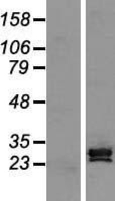 Western Blot: SCP3 Overexpression Lysate (Adult Normal) [NBL1-16635] Left-Empty vector transfected control cell lysate (HEK293 cell lysate); Right -Over-expression Lysate for SCP3.