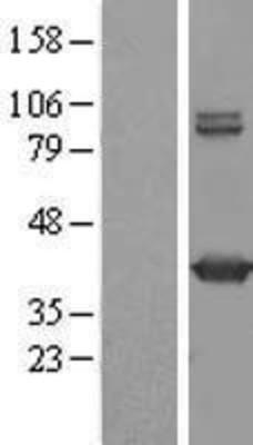 Western Blot: GMDS Overexpression Lysate (Adult Normal) [NBL1-11137] Left-Empty vector transfected control cell lysate (HEK293 cell lysate); Right -Over-expression Lysate for GMDS.