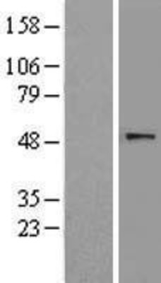 Western Blot: PPAR delta Overexpression Lysate (Adult Normal) [NBL1-14632] Left-Empty vector transfected control cell lysate (HEK293 cell lysate); Right -Over-expression Lysate for PPAR delta.