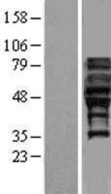 Western Blot: FAM113A Overexpression Lysate (Adult Normal) [NBL1-10447] Left-Empty vector transfected control cell lysate (HEK293 cell lysate); Right -Over-expression Lysate for FAM113A.