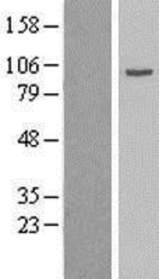 Western Blot: Gamma Adaptin Overexpression Lysate (Adult Normal) [NBL1-07575] Left-Empty vector transfected control cell lysate (HEK293 cell lysate); Right -Over-expression Lysate for Gamma Adaptin.