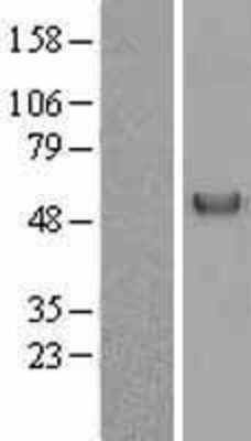 Western Blot: Vitamin D Binding Protein Overexpression Lysate (Adult Normal) [NBL1-10999] Left-Empty vector transfected control cell lysate (HEK293 cell lysate); Right -Over-expression Lysate for Vitamin D Binding Protein.