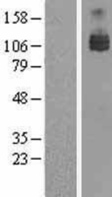Western Blot: Axl Overexpression Lysate (Adult Normal) [NBL1-07869] Left-Empty vector transfected control cell lysate (HEK293 cell lysate); Right -Over-expression Lysate for Axl.