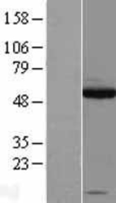 Western Blot: SOX10 Overexpression Lysate (Adult Normal) [NBL1-16344] Left-Empty vector transfected control cell lysate (HEK293 cell lysate); Right -Over-expression Lysate for SOX10.