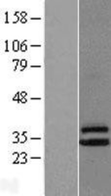 Western Blot: CLPP Overexpression Lysate (Adult Normal) [NBL1-09279] Left-Empty vector transfected control cell lysate (HEK293 cell lysate); Right -Over-expression Lysate for CLPP.