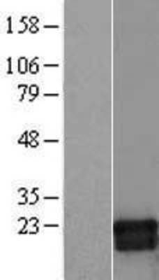 Western Blot: GMF beta Overexpression Lysate (Adult Normal) [NBL1-11139] Left-Empty vector transfected control cell lysate (HEK293 cell lysate); Right -Over-expression Lysate for GMF beta.