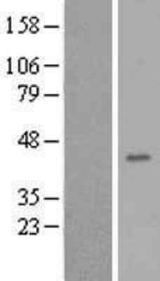Western Blot: FA2H Overexpression Lysate (Adult Normal) [NBL1-10415] Left-Empty vector transfected control cell lysate (HEK293 cell lysate); Right -Over-expression Lysate for FA2H.