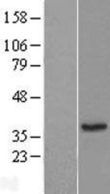 Western Blot: ERP27 Overexpression Lysate (Adult Normal) [NBL1-10337] Left-Empty vector transfected control cell lysate (HEK293 cell lysate); Right -Over-expression Lysate for ERP27.