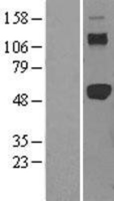 Western Blot: TRAF2 Overexpression Lysate (Adult Normal) [NBL1-17240] Left-Empty vector transfected control cell lysate (HEK293 cell lysate); Right -Over-expression Lysate for TRAF2.