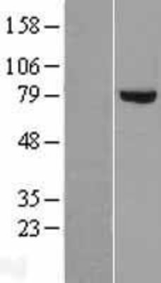 Western Blot: DGKA Overexpression Lysate (Adult Normal) [NBL1-09852] Left-Empty vector transfected control cell lysate (HEK293 cell lysate); Right -Over-expression Lysate for DGKA.