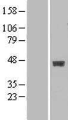 Western Blot: B3GALT4 Overexpression Lysate (Adult Normal) [NBL1-07878] Left-Empty vector transfected control cell lysate (HEK293 cell lysate); Right -Over-expression Lysate for B3GALT4.