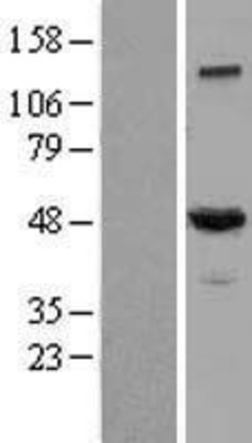 Western Blot: DCTN-50 Overexpression Lysate (Adult Normal) [NBL1-09750] Left-Empty vector transfected control cell lysate (HEK293 cell lysate); Right -Over-expression Lysate for DCTN-50.