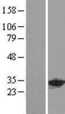 Western Blot: ANP32A Overexpression Lysate (Adult Normal) [NBL1-07550] Left-Empty vector transfected control cell lysate (HEK293 cell lysate); Right -Over-expression Lysate for ANP32A.