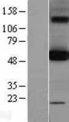 Western Blot: OXCT1 Overexpression Lysate (Adult Normal) [NBL1-14018] Left-Empty vector transfected control cell lysate (HEK293 cell lysate); Right -Over-expression Lysate for OXCT1.
