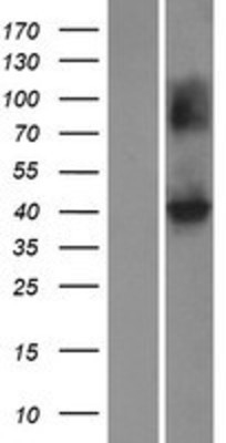 Western Blot: KCNJ10 Overexpression Lysate (Adult Normal) [NBP2-08133] Left-Empty vector transfected control cell lysate (HEK293 cell lysate); Right -Over-expression Lysate for KCNJ10.