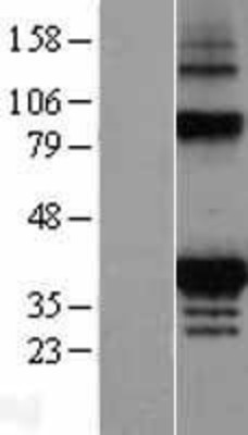 Western Blot: FAHD2A Overexpression Lysate (Adult Normal) [NBL1-10429] Left-Empty vector transfected control cell lysate (HEK293 cell lysate); Right -Over-expression Lysate for FAHD2A.