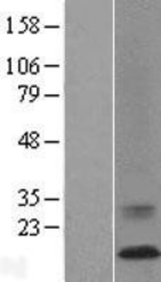 Western Blot: ATP6V0C Overexpression Lysate (Adult Normal) [NBL1-07833] Left-Empty vector transfected control cell lysate (HEK293 cell lysate); Right -Over-expression Lysate for ATP6V0C.