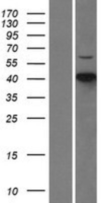 Western Blot: CDKL1 Overexpression Lysate (Adult Normal) [NBL1-09047] Left-Empty vector transfected control cell lysate (HEK293 cell lysate); Right -Over-expression Lysate for CDKL1.