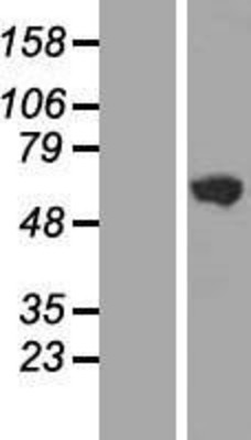 Western Blot: GHDC Overexpression Lysate (Adult Normal) [NBL1-11065] Left-Empty vector transfected control cell lysate (HEK293 cell lysate); Right -Over-expression Lysate for GHDC.