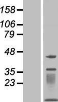 Western Blot: MOCS2 Overexpression Lysate (Adult Normal) [NBP2-05024] Left-Empty vector transfected control cell lysate (HEK293 cell lysate); Right -Over-expression Lysate for MOCS2.