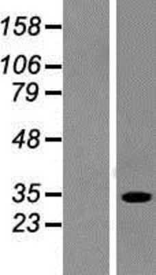 Western Blot: SULT1A2 Overexpression Lysate (Adult Normal) [NBP2-05012] Left-Empty vector transfected control cell lysate (HEK293 cell lysate); Right -Over-expression Lysate for SULT1A2.