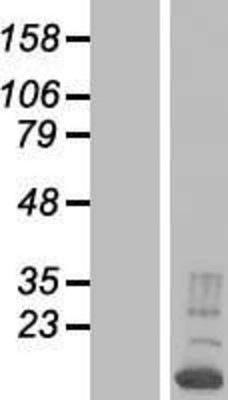 Western Blot: RNPC1 Overexpression Lysate (Adult Normal) [NBP2-04771] Left-Empty vector transfected control cell lysate (HEK293 cell lysate); Right -Over-expression Lysate for RNPC1.