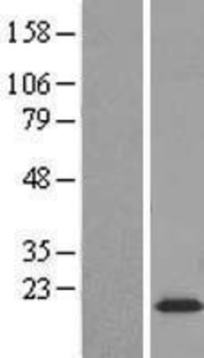 Western Blot: PBR Overexpression Lysate (Adult Normal) [NBL1-17384] - Western Blot experiments.  Left-Control; Right -Over-expression Lysate for TSPO
