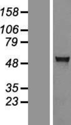 Western Blot: AGXT2L1 Overexpression Lysate (Adult Normal) [NBL1-07400] Left-Empty vector transfected control cell lysate (HEK293 cell lysate); Right -Over-expression Lysate for AGXT2L1.