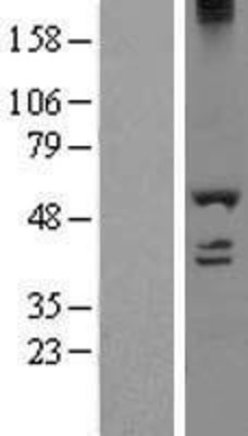 Western Blot: DDX19A Overexpression Lysate (Adult Normal) [NBL1-09784] Left-Empty vector transfected control cell lysate (HEK293 cell lysate); Right -Over-expression Lysate for DDX19A.