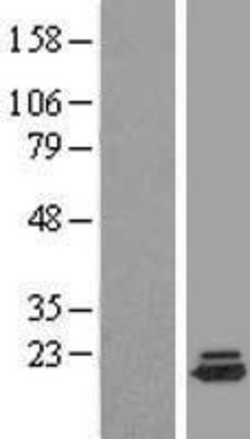 Western Blot: DYSFIP1 Overexpression Lysate (Adult Normal) [NBL1-10079] Left-Empty vector transfected control cell lysate (HEK293 cell lysate); Right -Over-expression Lysate for DYSFIP1.