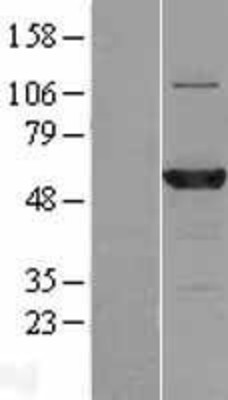 Western Blot: MB21D2 Overexpression Lysate (Adult Normal) [NBL1-08453] Left-Empty vector transfected control cell lysate (HEK293 cell lysate); Right -Over-expression Lysate for MB21D2.