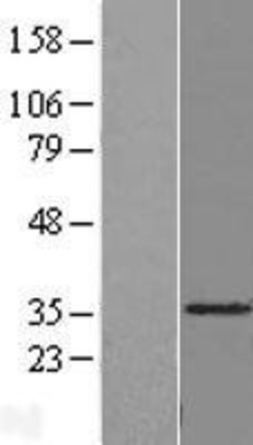 Western Blot: SDR39U1 Overexpression Lysate (Adult Normal) [NBL1-08171] Left-Empty vector transfected control cell lysate (HEK293 cell lysate); Right -Over-expression Lysate for SDR39U1.