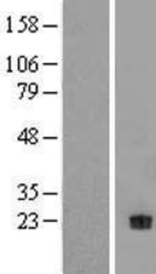 Western Blot: Neurotrophin 4 Overexpression Lysate (Adult Normal) [NBL1-13830] Left-Empty vector transfected control cell lysate (HEK293 cell lysate); Right -Over-expression Lysate for Neurotrophin 4.