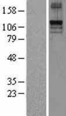 Western Blot: TLR9 Overexpression Lysate (Adult Normal) [NBL1-16957] Left-Empty vector transfected control cell lysate (HEK293 cell lysate); Right -Over-expression Lysate for TLR9.
