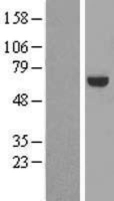 Western Blot: RABGGTA Overexpression Lysate (Adult Normal) [NBL1-15096] Left-Empty vector transfected control cell lysate (HEK293 cell lysate); Right -Over-expression Lysate for RABGGTA.