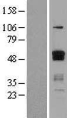 Western Blot: ETS1 Overexpression Lysate (Adult Normal) [NBL1-10355] Left-Empty vector transfected control cell lysate (HEK293 cell lysate); Right -Over-expression Lysate for ETS1.