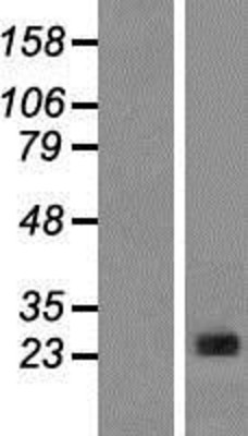 Western Blot: CLNS1A Overexpression Lysate (Adult Normal) [NBP2-08217] Left-Empty vector transfected control cell lysate (HEK293 cell lysate); Right -Over-expression Lysate for CLNS1A.