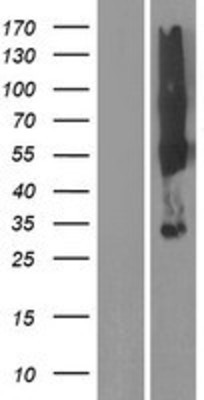 Western Blot: SYPL2 Overexpression Lysate (Adult Normal) [NBP2-08354] Left-Empty vector transfected control cell lysate (HEK293 cell lysate); Right -Over-expression Lysate for SYPL2.