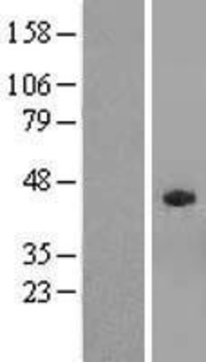 Western Blot: SPAG4L Overexpression Lysate (Adult Normal) [NBL1-16364] Left-Empty vector transfected control cell lysate (HEK293 cell lysate); Right -Over-expression Lysate for SPAG4L.