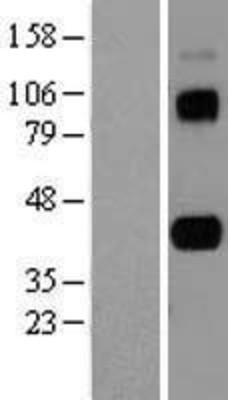 Western Blot: CD5L Overexpression Lysate (Adult Normal) [NBL1-08959] Left-Empty vector transfected control cell lysate (HEK293 cell lysate); Right -Over-expression Lysate for CD5L.