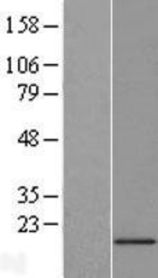 Western Blot: EIF1AY Overexpression Lysate (Adult Normal) [NBL1-10172] Left-Empty vector transfected control cell lysate (HEK293 cell lysate); Right -Over-expression Lysate for EIF1AY.