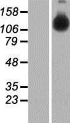 Western Blot: DNA helicase B Overexpression Lysate (Adult Normal) [NBP2-05870] Left-Empty vector transfected control cell lysate (HEK293 cell lysate); Right -Over-expression Lysate for DNA helicase B.