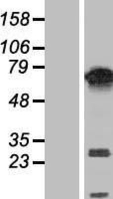 Western Blot: PUF60 Overexpression Lysate (Adult Normal) [NBP2-05786] Left-Empty vector transfected control cell lysate (HEK293 cell lysate); Right -Over-expression Lysate for PUF60.