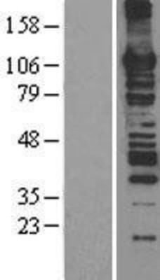 Western Blot: MCM6 Overexpression Lysate (Adult Normal) [NBL1-12955] Left-Empty vector transfected control cell lysate (HEK293 cell lysate); Right -Over-expression Lysate for MCM6.